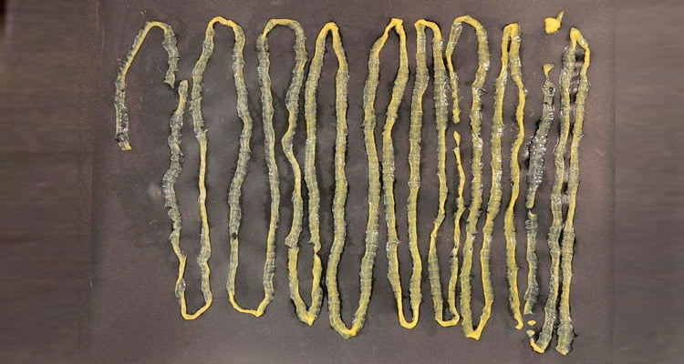 Verme de 2,8m do tipo tênia retirado do ânus do paciente – Foto: Singapore General Hospital's Department of Microbiology/ S1 Notícias