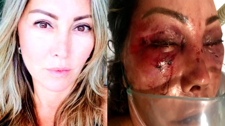 Mulher é agredida durante quatro horas em primeiro encontro