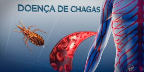Surto de doença de Chagas é investigado no Sertão de PE