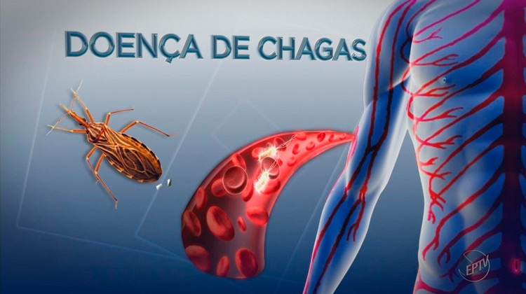 Surto de doença de Chagas é investigado no Sertão de PE