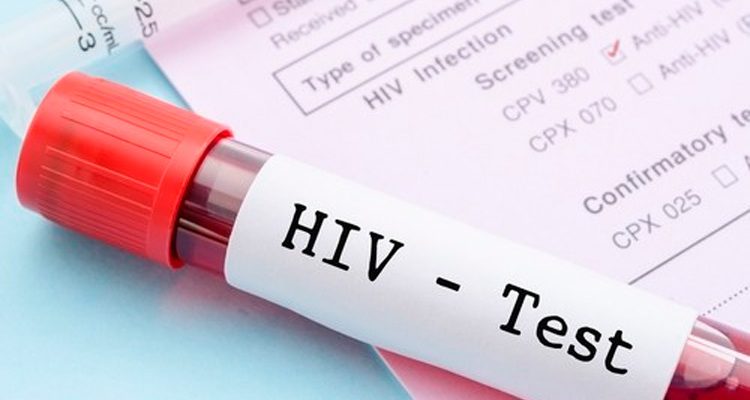 Vacina contra o HIV será testada em humanos pela primeira vez no Brasil