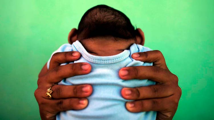 Bolsonaro assina MP que garante pensão vitalícia para crianças com microcefalia