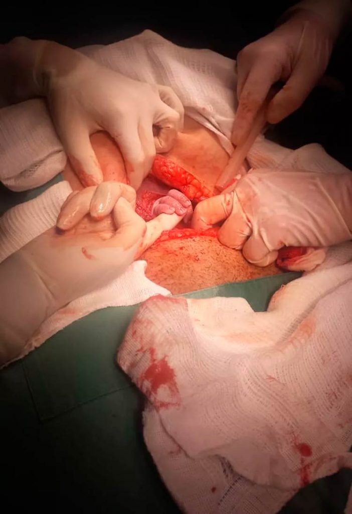 Avó registra momento em que bebê nasce e segura dedo de médica em MS — Foto: Ana Rego/Arquivo Pessoal