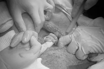 Ao abrir barriga em cesárea, bebê segura dedo de médica e emociona equipe e família