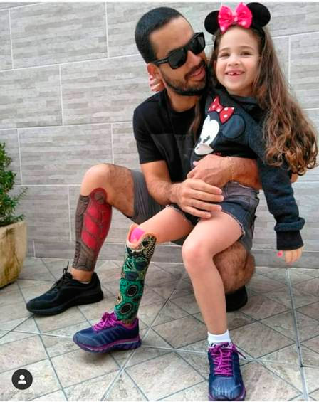 Pai tatua prótese na perna para ficar igual à filha