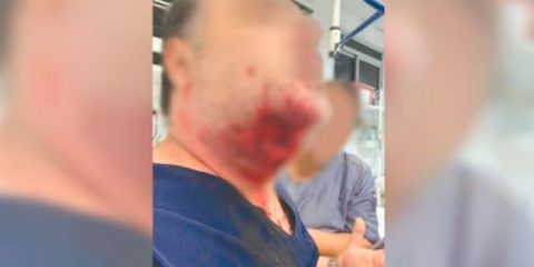 Paciente morde médico na jugular em hospital do interior de SP