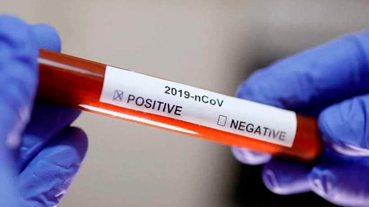 37 casos de coronavírus são confirmados no Brasil