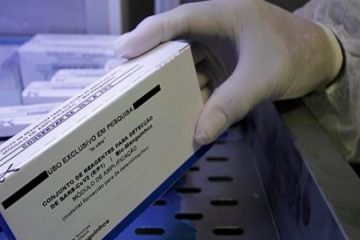 Pernambuco recebe kits da Fiocruz e vai poder detectar coronavírus em menos de 24 horas