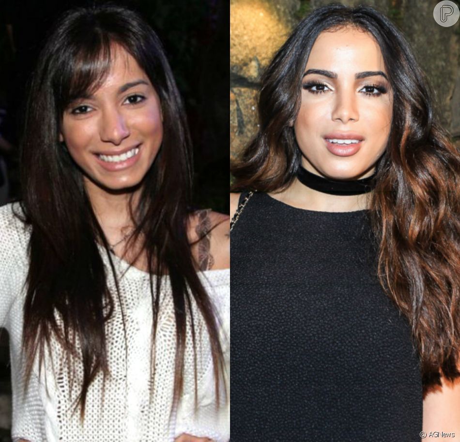 Fotos de Anitta antes e depois da fama - S1 Notícias. 