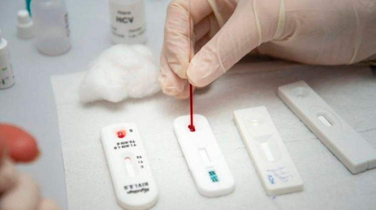 Anvisa aprova testes rápidos para Covid-19 em farmácias