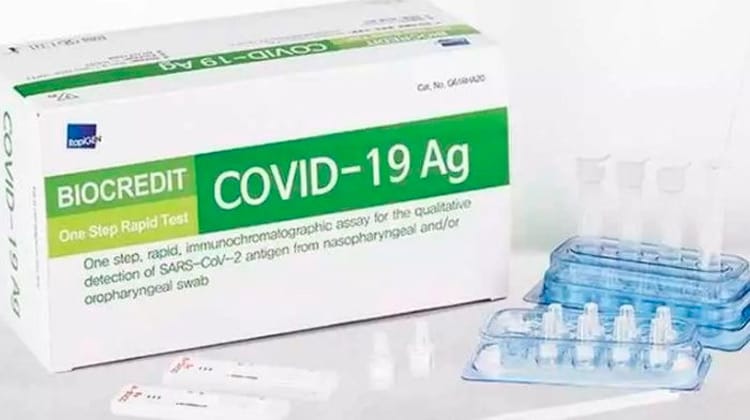 Coronavírus: teste que dá o resultado em menos de 10 minutos chega ao Brasil