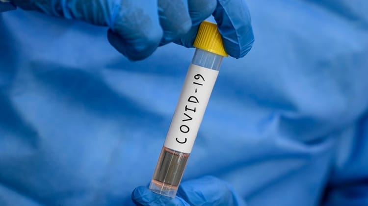 Pernambuco confirma 1.714 novos casos da Covid-19 e 53 óbitos