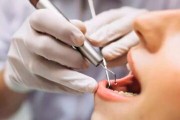 Estresse da quarentena causa aumento em casos de dente quebrado