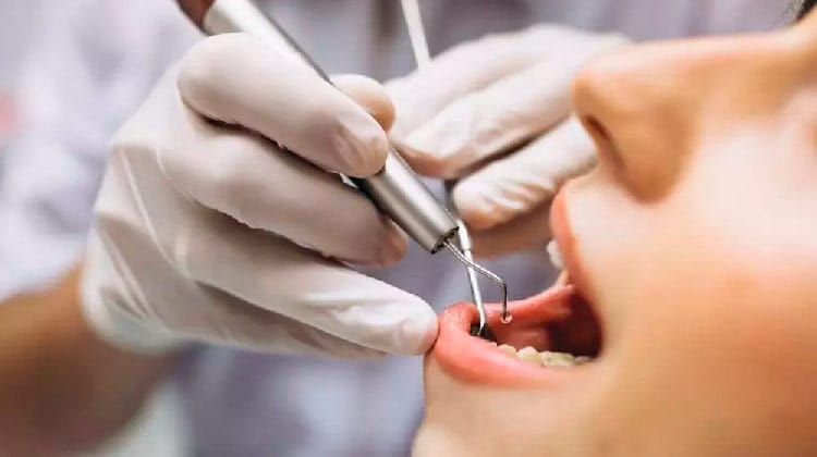 Estresse da quarentena causa aumento em casos de dente quebrado