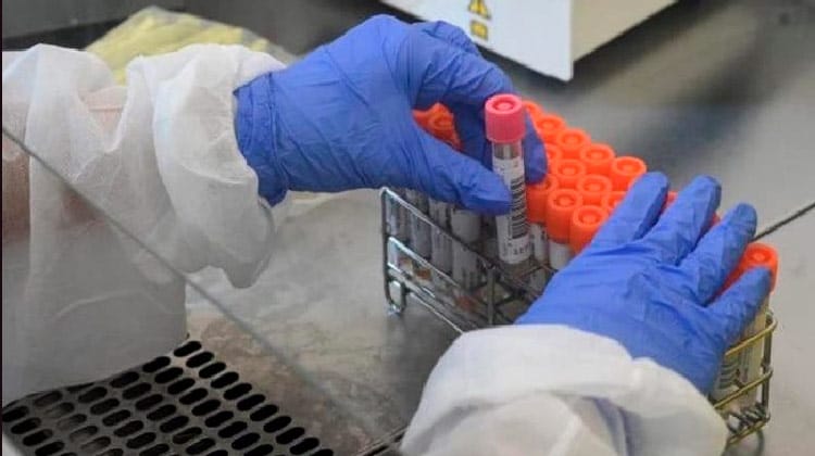 Pernambuco confirma 1.488 novos casos e 41 óbitos por Covid-19