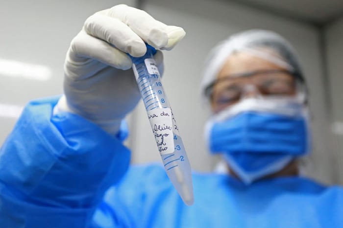 Pernambuco registra 1.069 novos casos e 20 óbitos por Covid-19