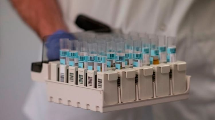 Covid-19: Brasil chega a 3.997.865 infecções e deve passar 4 milhões nesta quinta