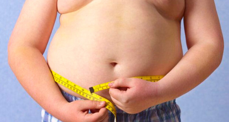 Criança obesa tem 80% de chance de se tornar um adulto obeso