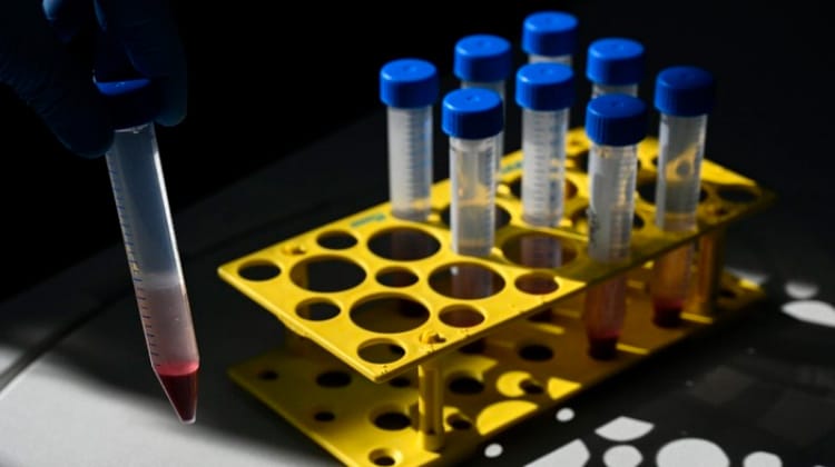 Covid-19: Brasil passa de 5,7 milhões de casos