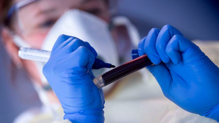 Covid-19: Sertão do Pajeú chega perto dos 19 mil casos confirmados nesta terça-feira