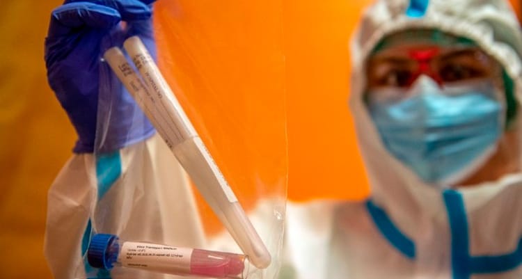 Com 82 mortes, Pernambuco bate recorde de óbitos por Covid-19 notificados em 24h em 2021