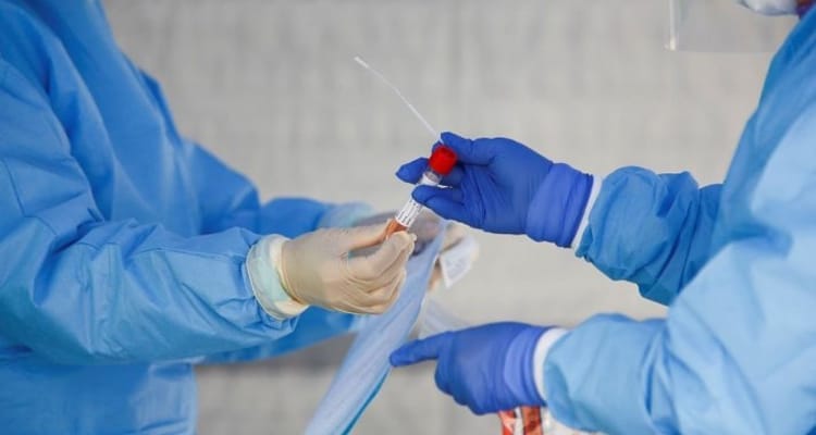 Pernambuco registra 701 novos casos e mais 31 óbitos por Covid-19