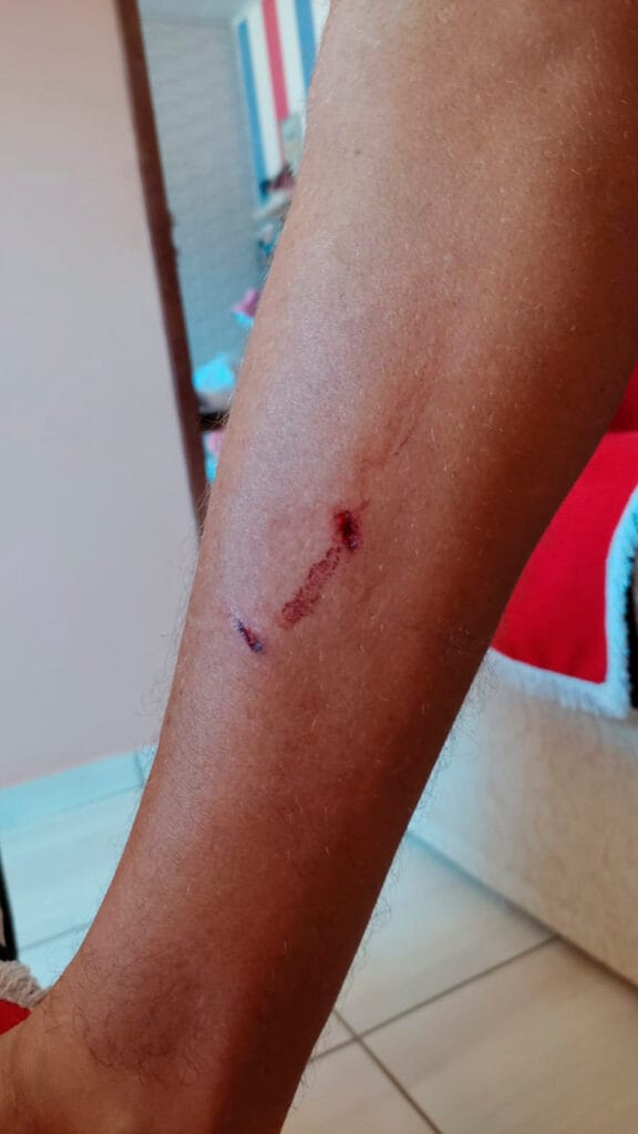 Cachorro ataca pessoas em Solidão-PE