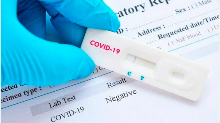 Anvisa aprova novo teste de diagnóstico para Covid-19
