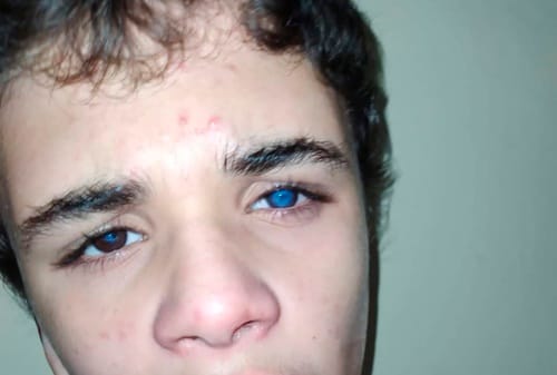 Em Juro mãe faz apelo para filho autista que corre risco de perder totalmente a visão, “ajudem meu filho”