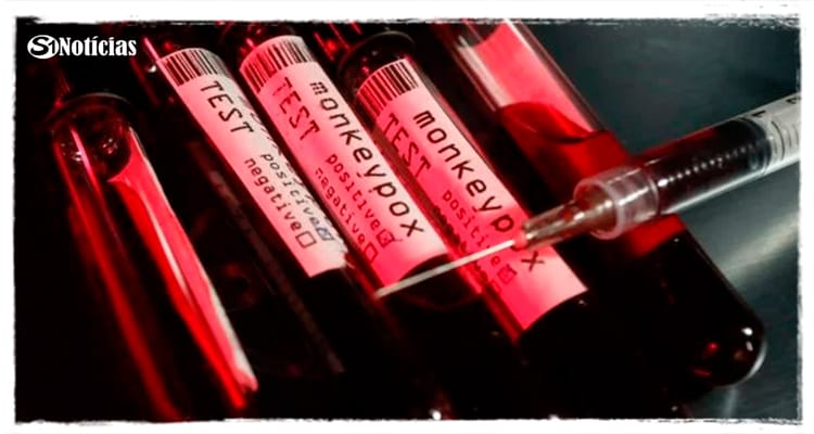 Anvisa libera uso de vacina e antiviral contra a varíola dos macacos