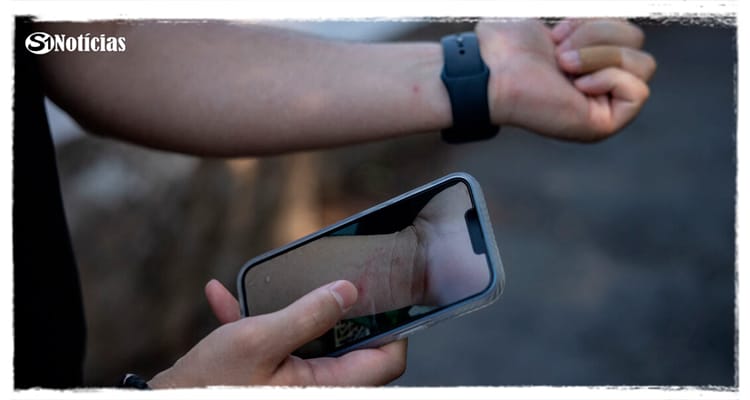 Tabira, Afogados Serra e São José com casos suspeitos de Varíola dos Macacos