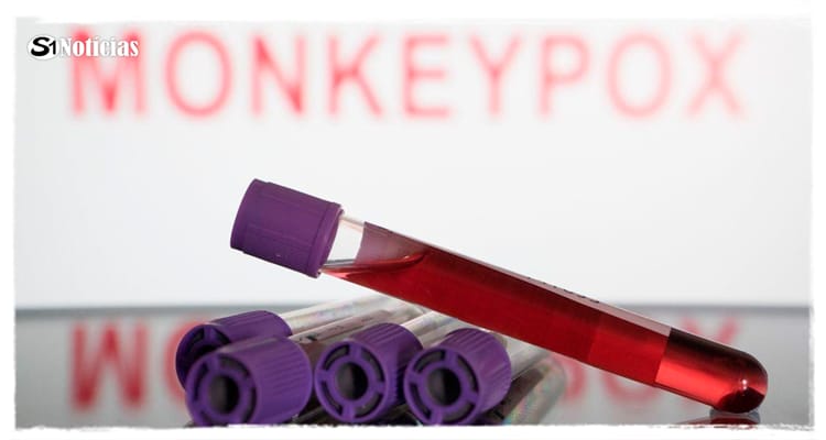 Brasil tem oitava morte por monkeypox confirmada