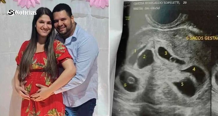 Casal descobre gestação de sêxtuplos em ultrassom de um bebê