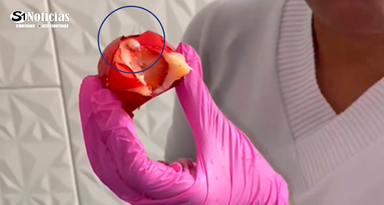 Confeiteira viraliza ao quebrar dente depois de morder ‘morango do amor’
