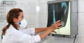 Pernambuco mantém alta de casos de tuberculose em 2025, com mais de 6 mil notificações